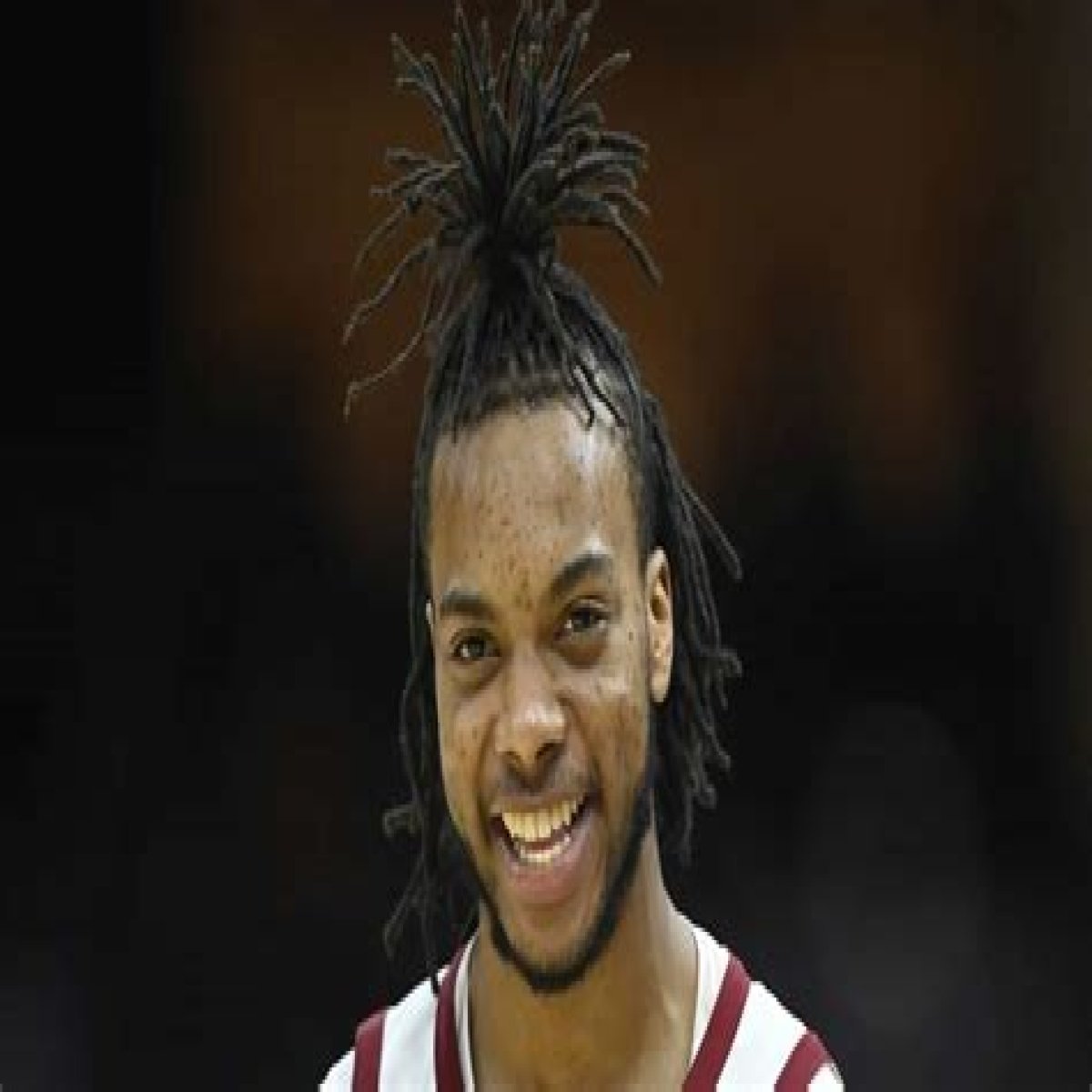 Cleveland Cavaliers: Darius Garland Injury - Long Hairstyle – How Did He Grow His Hair