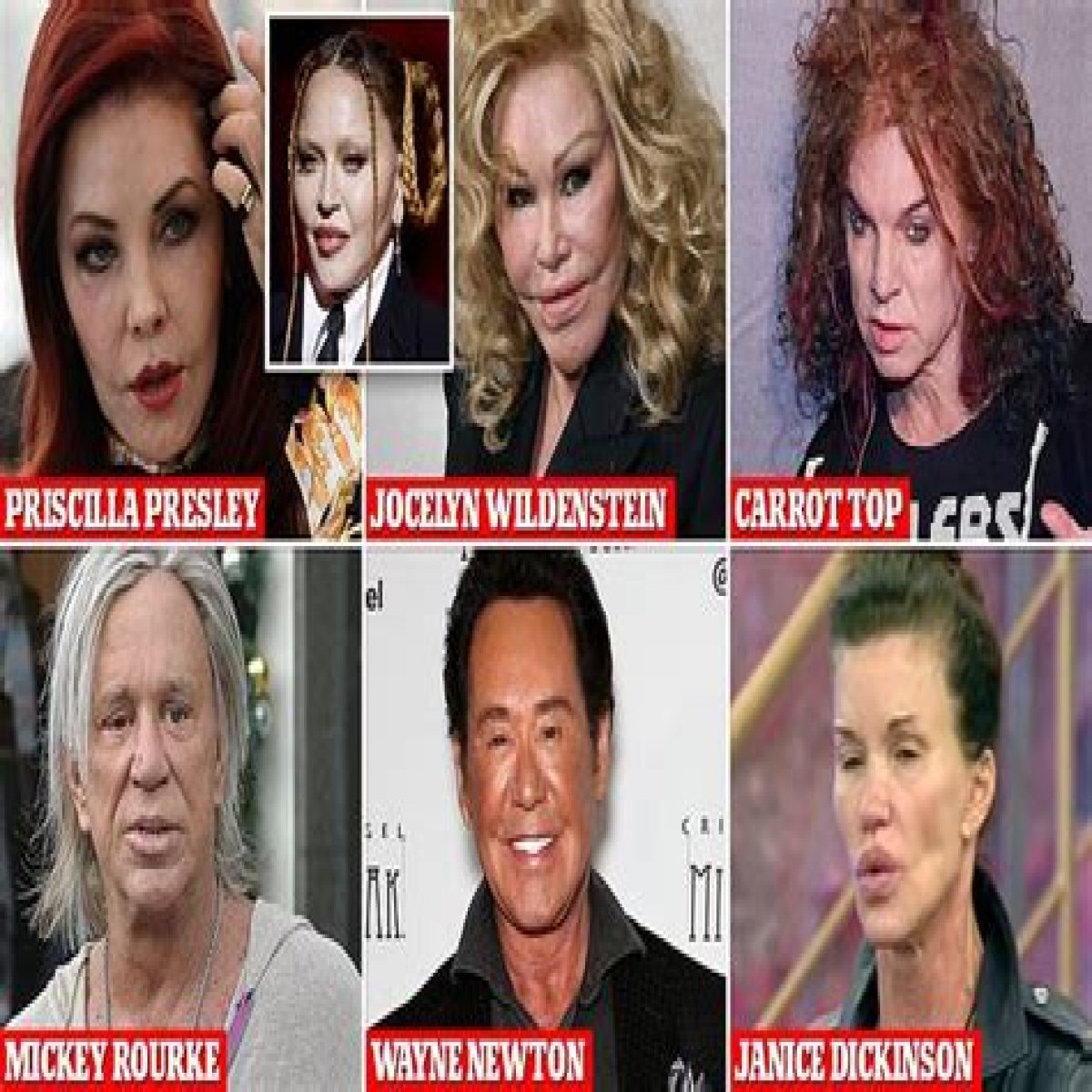Has the TV Star Ever Had Plastic Surgery?